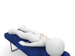 Czy akupunktura to medycyna alternatywna?